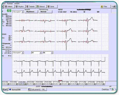 Ruhe-EKG mit unauffälligem Befund